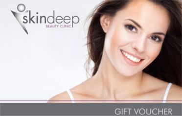 Gift Vouchers